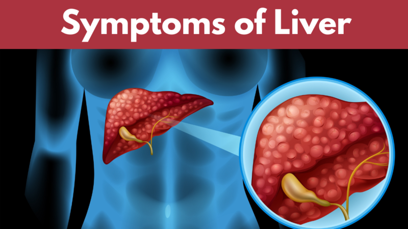 Symptoms of Liver Disease